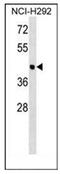 Otolin 1 antibody, AP53127PU-N, Origene, Western Blot image 