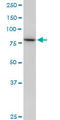 SET Domain Bifurcated Histone Lysine Methyltransferase 2 antibody, LS-C139445, Lifespan Biosciences, Western Blot image 