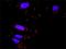 ETS domain-containing protein Elk-1 antibody, H00002002-M01, Novus Biologicals, Proximity Ligation Assay image 