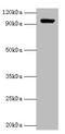 Hexokinase 1 antibody, A54597-100, Epigentek, Western Blot image 