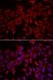 Cysteine And Glycine Rich Protein 3 antibody, LS-C334803, Lifespan Biosciences, Immunofluorescence image 