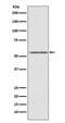 Anti-Mullerian Hormone Receptor Type 2 antibody, M03970, Boster Biological Technology, Western Blot image 