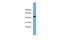 Proteasome 26S Subunit, Non-ATPase 12 antibody, PA5-44848, Invitrogen Antibodies, Western Blot image 