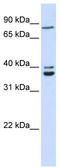 Tubulin Polyglutamylase Complex Subunit 2 antibody, TA333814, Origene, Western Blot image 