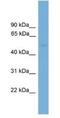 Protein Phosphatase 2 Regulatory Subunit B'Epsilon antibody, NBP1-79638, Novus Biologicals, Western Blot image 