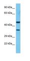 Complement Factor H Related 3 antibody, orb325737, Biorbyt, Western Blot image 