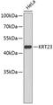 Keratin 23 antibody, 18-756, ProSci, Western Blot image 