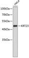 Keratin, type I cytoskeletal 23 antibody, 18-756, ProSci, Western Blot image 