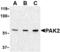 P21 (RAC1) Activated Kinase 2 antibody, MBS151095, MyBioSource, Western Blot image 