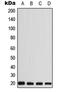 Calcium Binding Protein 5 antibody, LS-C353490, Lifespan Biosciences, Western Blot image 