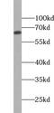 Zinc Finger Protein 654 antibody, FNab09724, FineTest, Western Blot image 