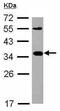 C-X-C Motif Chemokine Ligand 16 antibody, ab101404, Abcam, Western Blot image 