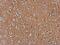 AXL Receptor Tyrosine Kinase antibody, NBP2-15530, Novus Biologicals, Immunohistochemistry frozen image 