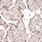 Cyclin E2 antibody, 15-363, ProSci, Immunohistochemistry paraffin image 