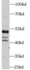 Phosphatase And Tensin Homolog antibody, FNab09821, FineTest, Western Blot image 