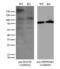 Bromodomain Adjacent To Zinc Finger Domain 1B antibody, LS-C796617, Lifespan Biosciences, Western Blot image 