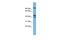 Exocyst Complex Component 5 antibody, PA5-43781, Invitrogen Antibodies, Western Blot image 