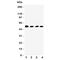 Serpin Family C Member 1 antibody, R31342, NSJ Bioreagents, Western Blot image 
