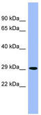 Phytanoyl-CoA dioxygenase, peroxisomal antibody, TA345151, Origene, Western Blot image 