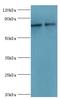 MRE11 Homolog, Double Strand Break Repair Nuclease antibody, MBS1493565, MyBioSource, Western Blot image 
