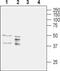 Aquaporin 11 antibody, PA5-77715, Invitrogen Antibodies, Western Blot image 