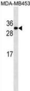 DNA Damage Inducible Transcript 3 antibody, abx025518, Abbexa, Western Blot image 