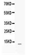 Matrix Gla Protein antibody, PA5-79669, Invitrogen Antibodies, Western Blot image 