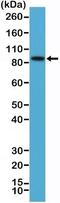 B-Raf Proto-Oncogene, Serine/Threonine Kinase antibody, NBP2-61499, Novus Biologicals, Western Blot image 