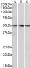 Protein Phosphatase 2 Regulatory Subunit B'Epsilon antibody, PA5-17981, Invitrogen Antibodies, Western Blot image 