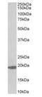 MCTS1 Re-Initiation And Release Factor antibody, orb12294, Biorbyt, Western Blot image 