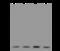 Fission, Mitochondrial 1 antibody, 200349-T44, Sino Biological, Western Blot image 