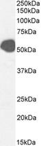 Solute Carrier Family 2 Member 2 antibody, CL8886AP, Cedarlane Labs, Western Blot image 