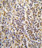 Aldehyde Dehydrogenase 1 Family Member A3 antibody, 63-240, ProSci, Immunofluorescence image 