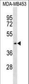 Zinc Finger Protein 701 antibody, LS-C157495, Lifespan Biosciences, Western Blot image 