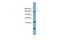 ERCC Excision Repair 6 Like, Spindle Assembly Checkpoint Helicase antibody, A07663, Boster Biological Technology, Western Blot image 