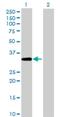 Acyl-CoA Binding Domain Containing 4 antibody, H00079777-B01P, Novus Biologicals, Western Blot image 