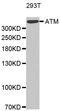 ATM Serine/Threonine Kinase antibody, LS-C334383, Lifespan Biosciences, Western Blot image 