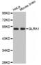 Glycine Receptor Alpha 1 antibody, abx002153, Abbexa, Western Blot image 