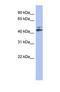 Cytochrome P450 Family 20 Subfamily A Member 1 antibody, NBP1-69680, Novus Biologicals, Western Blot image 