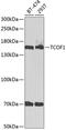 Treacle Ribosome Biogenesis Factor 1 antibody, GTX16408, GeneTex, Western Blot image 