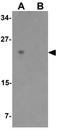 Basic Helix-Loop-Helix Family Member A15 antibody, GTX31558, GeneTex, Western Blot image 
