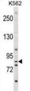 Exostosin Glycosyltransferase 1 antibody, abx029097, Abbexa, Western Blot image 