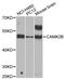 Calcium/Calmodulin Dependent Protein Kinase II Beta antibody, MBS128632, MyBioSource, Western Blot image 