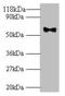 HPV18 Major capsid protein L1 antibody, orb240687, Biorbyt, Western Blot image 