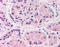 HIF1-alpha antibody, LS-C83706, Lifespan Biosciences, Immunohistochemistry paraffin image 