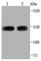 Apoptosis-stimulating of p53 protein 2 antibody, A02609-2, Boster Biological Technology, Western Blot image 