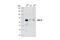 Interleukin 1 Receptor Associated Kinase 3 antibody, 4369T, Cell Signaling Technology, Western Blot image 