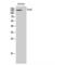 Desmoglein 2 antibody, LS-C383209, Lifespan Biosciences, Western Blot image 