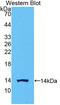 Chorionic Gonadotropin Subunit Beta 1 antibody, LS-C374445, Lifespan Biosciences, Western Blot image 