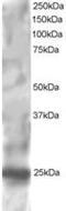 Regulator Of G Protein Signaling 1 antibody, MBS420870, MyBioSource, Western Blot image 